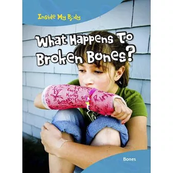 What happens to broken bones?  : bones