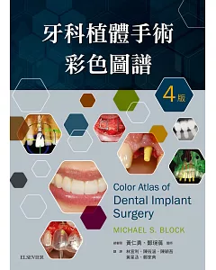 牙科植體手術彩色圖譜（4版）