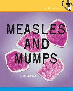 Measles and Mumps