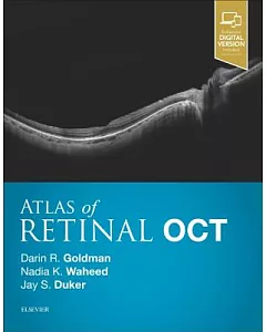 Atlas of Retinal Oct: Optical Coherence Tomography
