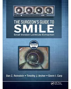 The Surgeon’s Guide to Smile: Small Incision Lenticule Extraction