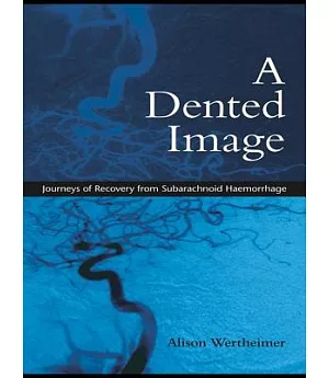 A Dented Image: Journeys of Recovery from Subarachnoid Haemorrhage
