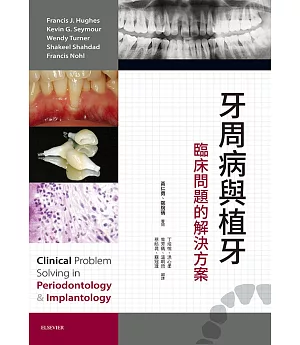 牙周病與植牙：臨床問題的解決方案