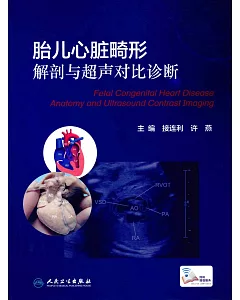 胎兒心臟畸形解剖與超聲對比診斷