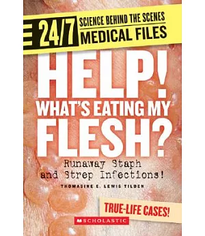 Help! What’s Eating My Flesh?: Runaway Staph and Strep Infections!