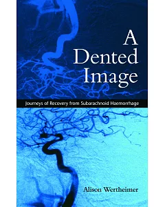 A Dented Image: Journeys of Recovery from Subarachnoid Haemorrhage