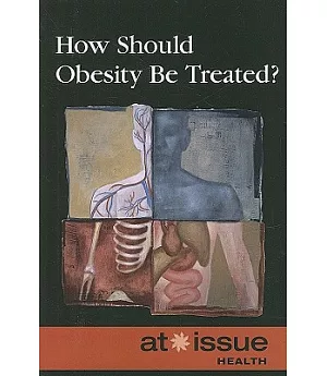 How Should Obesity Be Treated?