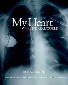 My Heart Vs. The Real World: Children With Heart Disease, in Photographs & Interviews