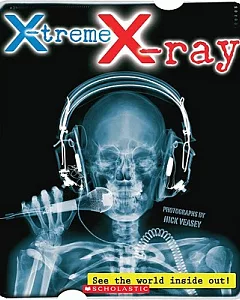X-Treme X-ray: See the World Inside Out!