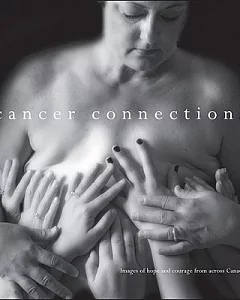 Cancer Connections: Images of Hope and Courage from Across Canada
