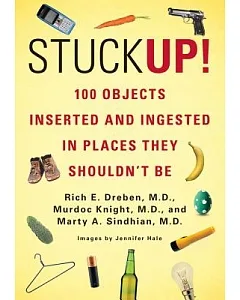 Stuck Up!: 100 Objects Inserted and Ingested in Places They Shouldn’t Be