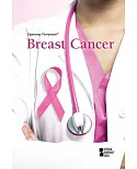 Breast Cancer