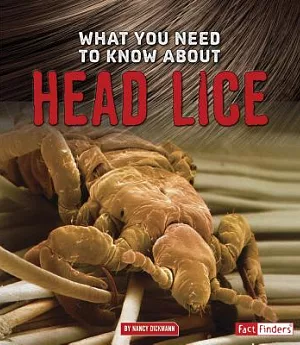 What You Need to Know About Head Lice