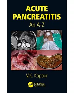 Acute Pancreatitis: An A-z