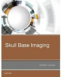 Skull Base Imaging