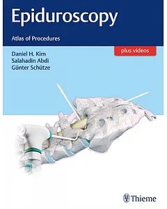 Epiduroscopy: Atlas of Procedures