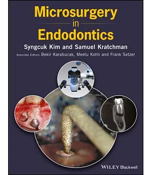 Microsurgery in Endodontics