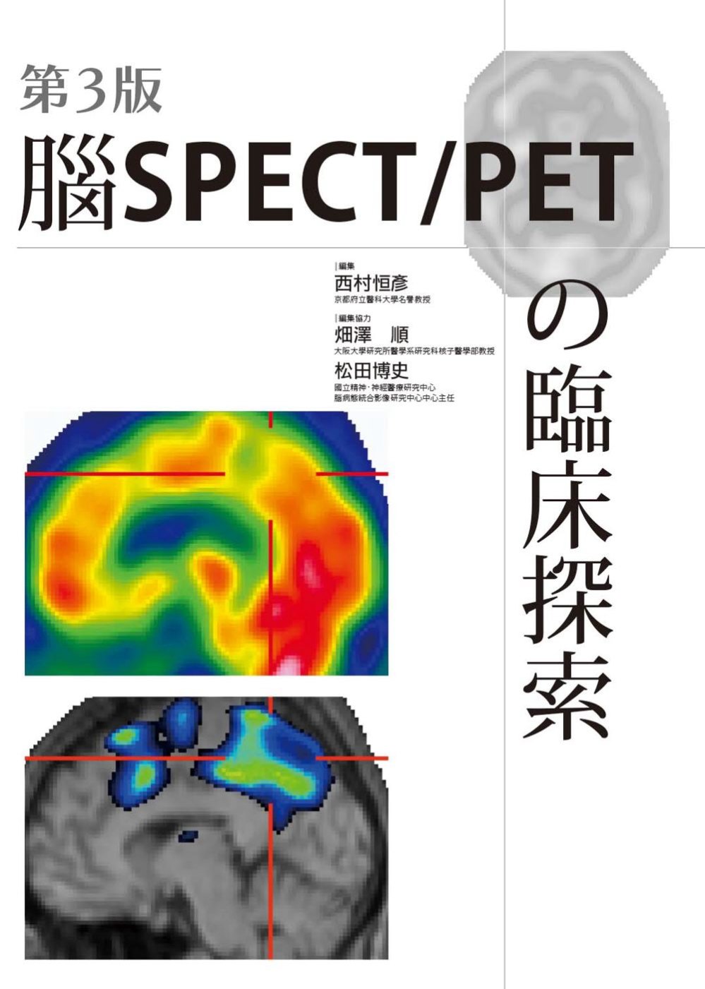 腦SPECT/PETの臨床探索(...