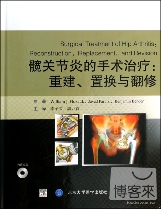 髖關節炎的手術治療：重建、置換與翻修