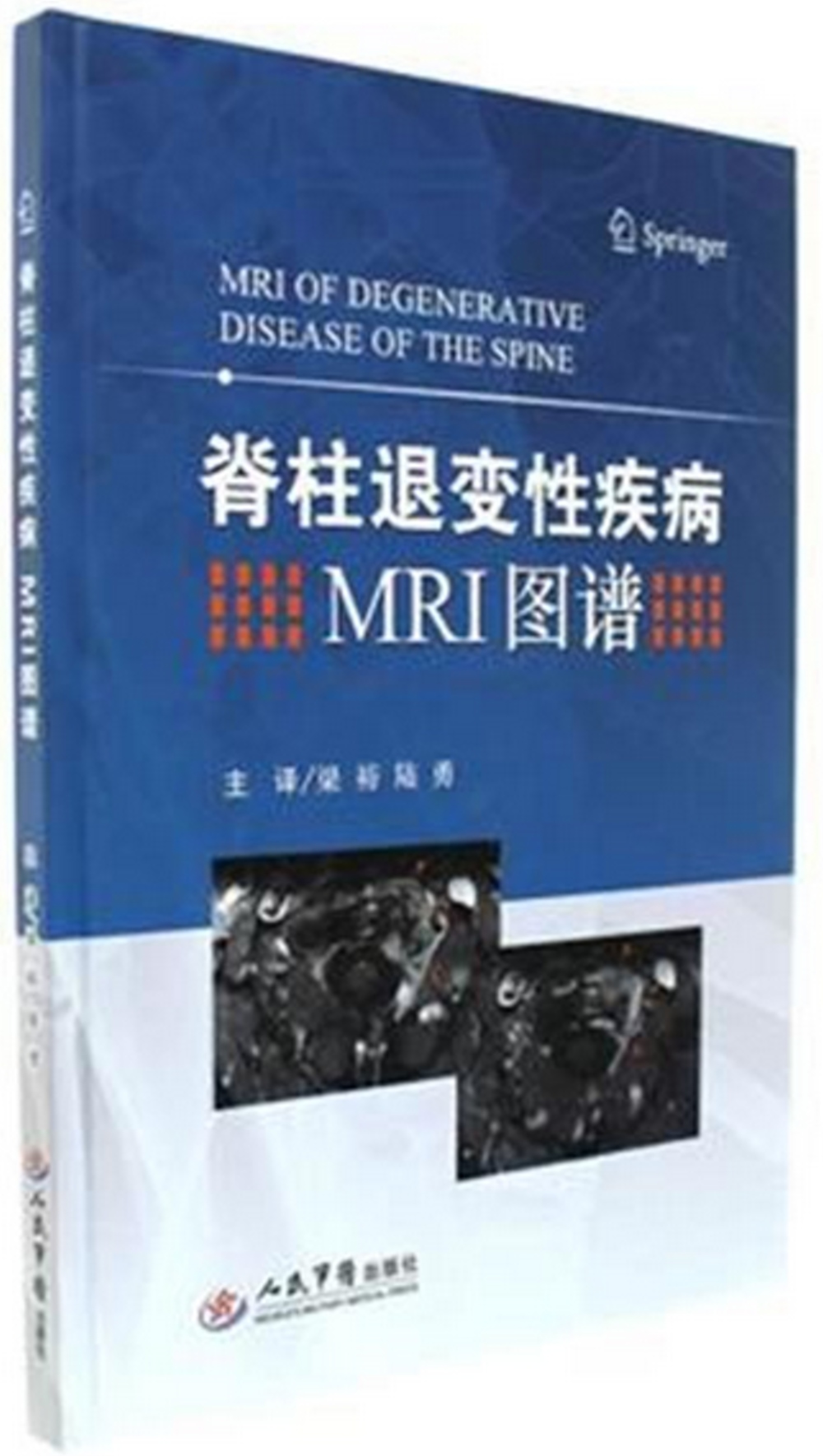 脊柱退變性疾病MRI圖譜