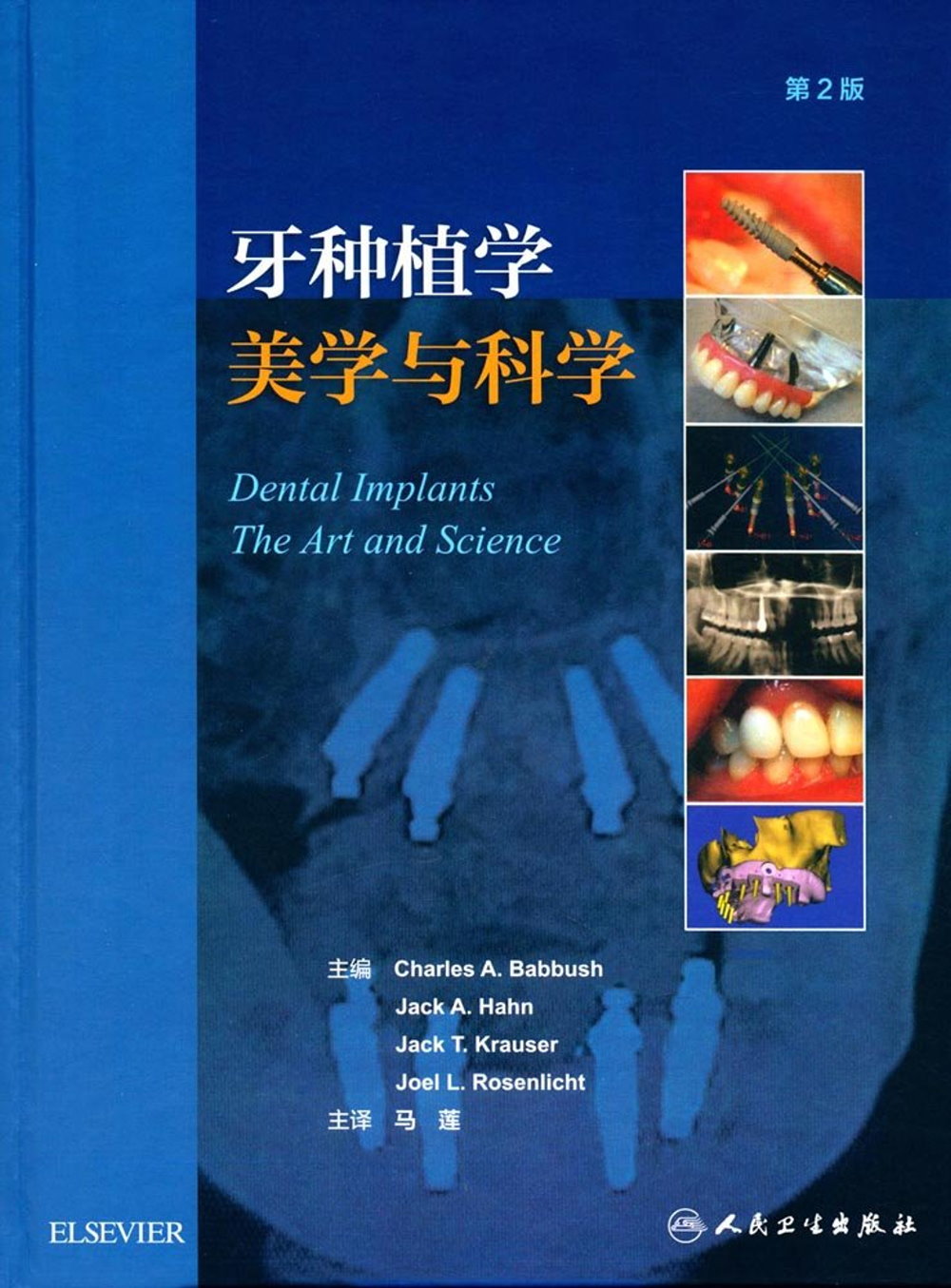 牙種植學：美學與科學（第2版）