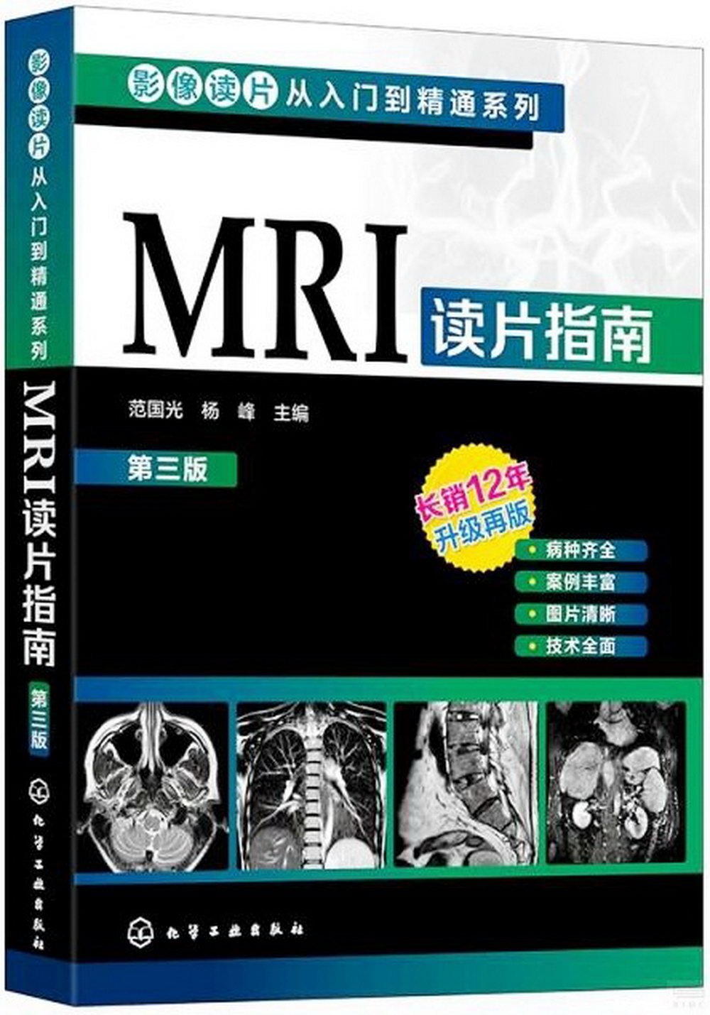 MRI讀片指南（第三版）