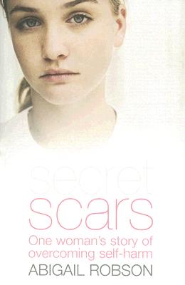 Secret Scars: One Womans Story of Overcoming Self Harm
