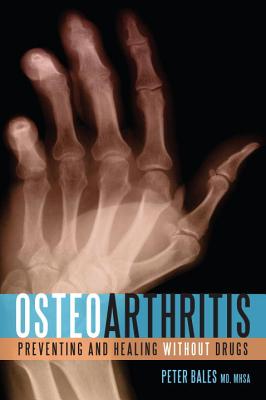 Osteoarthritis: Preventing and Healing Without Drugs
