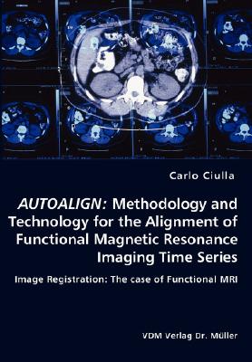 Autoalign: Methodology and Technology for the Alignment of Functional Magnetic Resonance Imaging Time Series: Image Registration