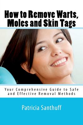 How to Remove Warts, Moles and Skin Tags: Your Comprehensive Guide to Safe and Effective Removal