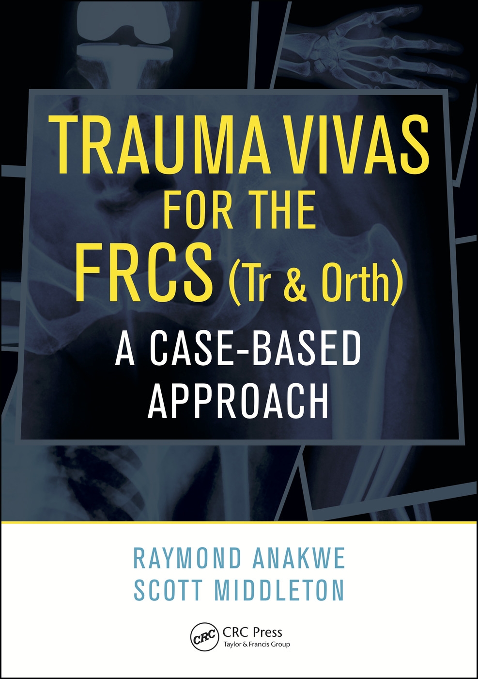 Trauma Vivas for the FRCS (Tr & Orth): A Case-Based Approach