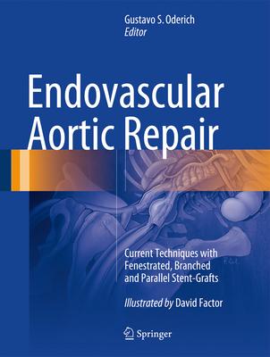 Endovascular Aortic Repair: Current Techniques With Fenestrated, Branched and Parallel Stent-grafts