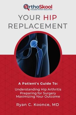 Your Hip Replacement: A Patient’’s Guide To: Understanding Hip Arthritis, Preparing for Surgery, Maximizing Your Outcome