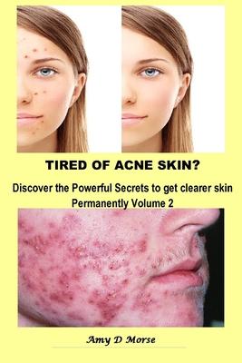 TIRED OF ACNE SKIN? Discover the Powerful Secrets to get Clearer Skin Permanently