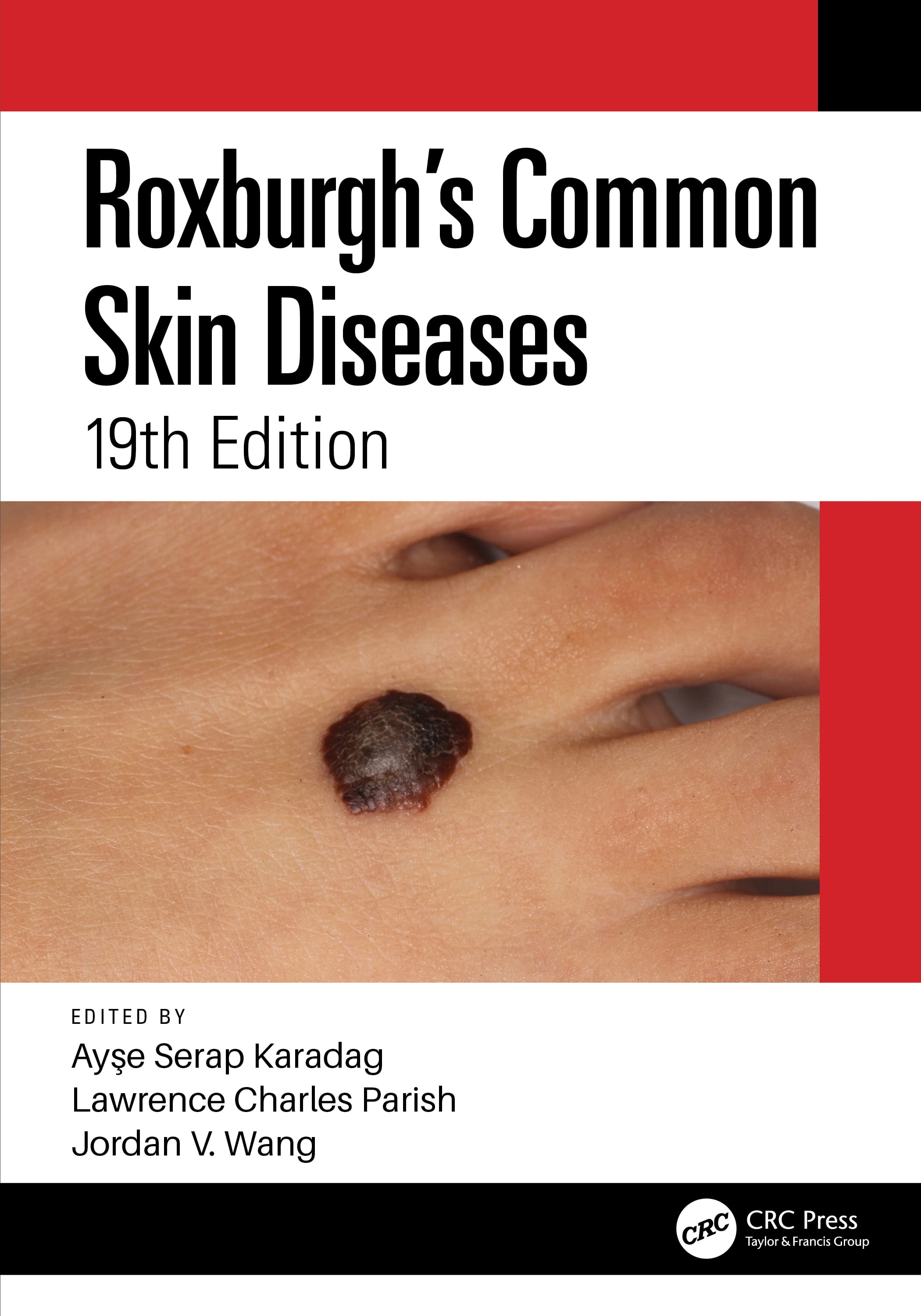 Roxburgh’’s Common Skin Diseases