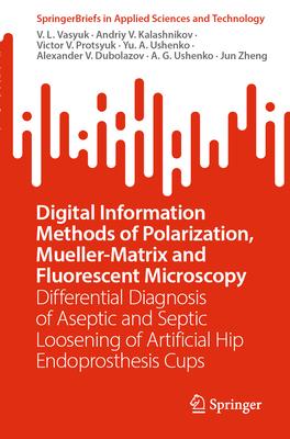 Digital Information Methods of Polarization, Mueller-Matrix and Fluorescent Microscopy: Differential Diagnosis of Aseptic and Septic Loosening of Arti
