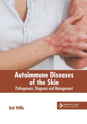 Autoimmune Diseases of the Skin: Pathogenesis, Diagnosis and Management