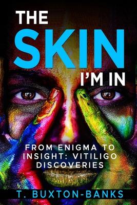 The Skin I’m In: From Enigma to Insight: Vitiligo Discoveries