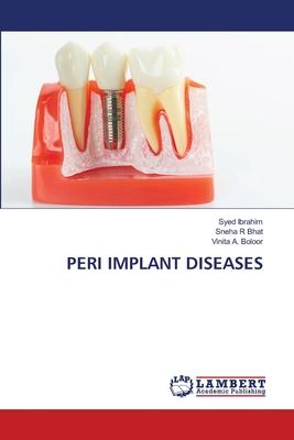 Peri Implant Diseases