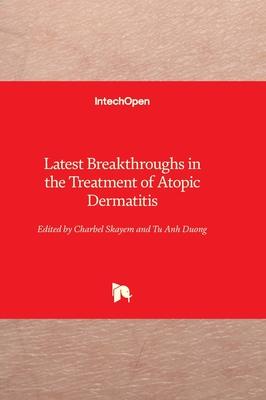Latest Breakthroughs in the Treatment of Atopic Dermatitis